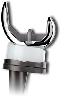 Persona The Personalized Knee System Featuring The Zimmer Psi Knee