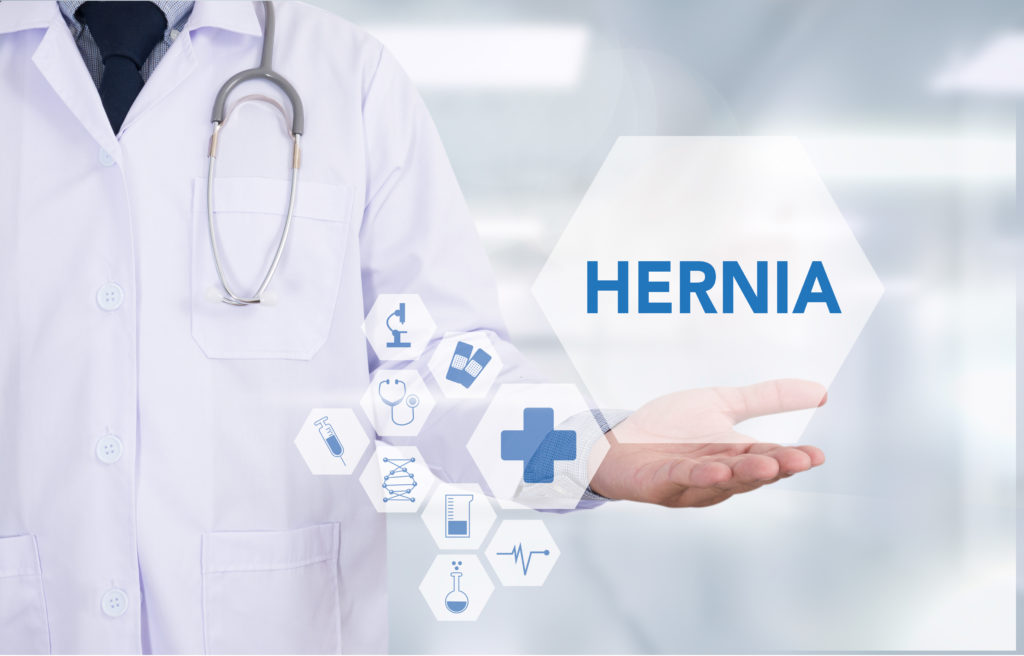 hernia mesh